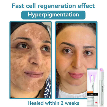 LUMIVO™ All-in-One CO₂ Laser Eraser Pen | Removes Moles, Warts, Skin Flaws & Pigmentation